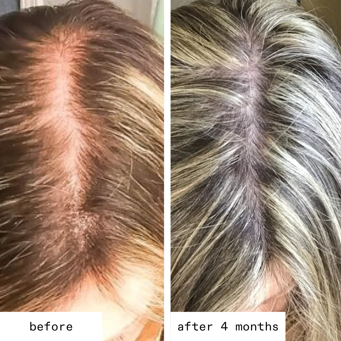 Welloura Postpartum